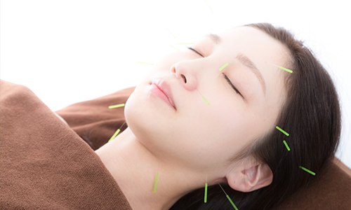 美容鍼